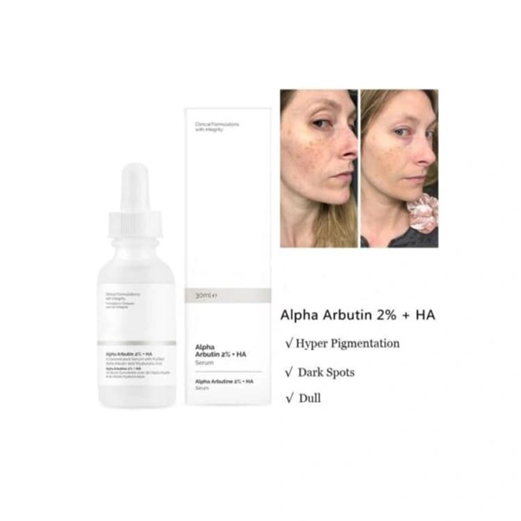 سرم ضد لک The Ordinary مدل Alpha Arbutin حجم 30 میلی لیتر — تصویر ۷