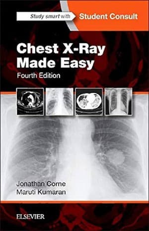 دانلود کتاب Chest X-Ray Made Easy-4th Edition — تصویر ۲