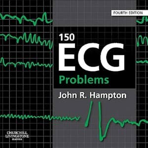 دانلود کتاب 150 ECG problems by John R Hampton — تصویر ۲