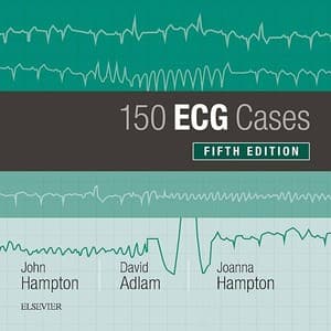 دانلود کتاب 150 cases in ECG 5th edition