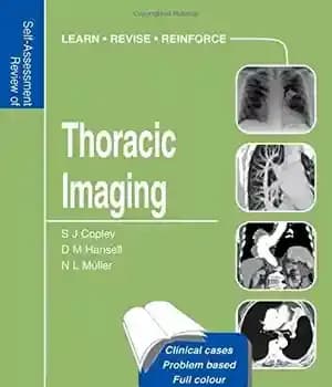 دانلود کتاب Self-assessment Colour Review of Thoracic Imaging – بررسی رنگ خود ارزیابی تصویربرداری قفسه سینه