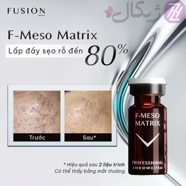 کوکتل درمان جای جوش فیوژن F-MESO MATRIX — تصویر ۴