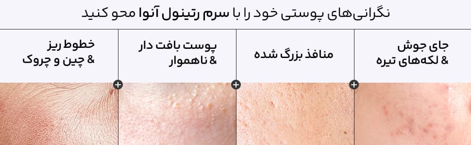 سرم ضد چروک و روشن کننده رتینول آنوا — تصویر ۴