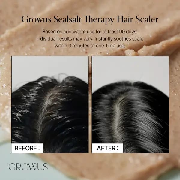 اسکراب کف سر نمک دریا گروسGrowus — تصویر ۲