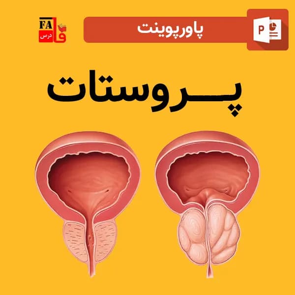 پاورپوینت درباره پروستات