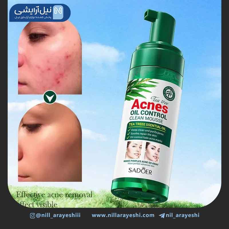 فوم شستشو صورت پمپی ضد جوش و آکنه تی تری سادور کد SD62685 — تصویر ۲
