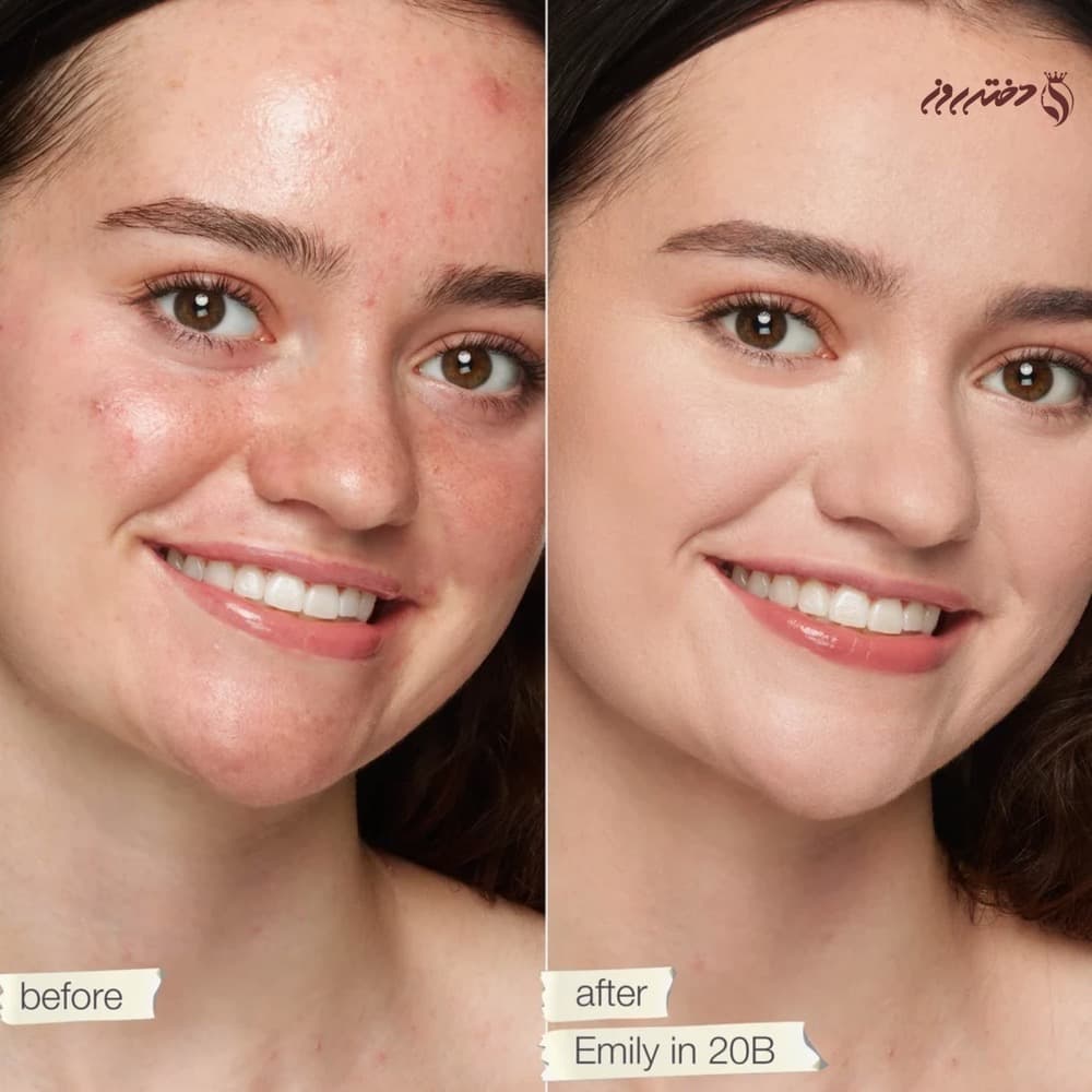 کانسیلر تارت | Double duty beauty concealer tarte 20B — تصویر ۲