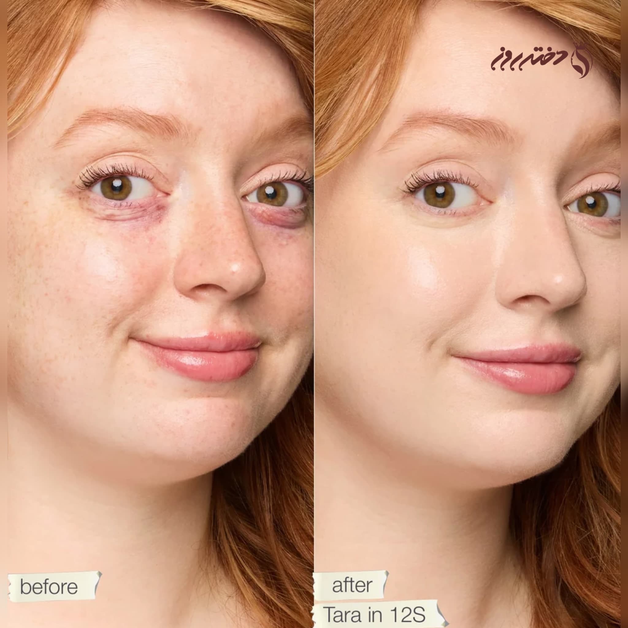 کانسیلر تارت | Double duty beauty concealer tarte 12S — تصویر ۲