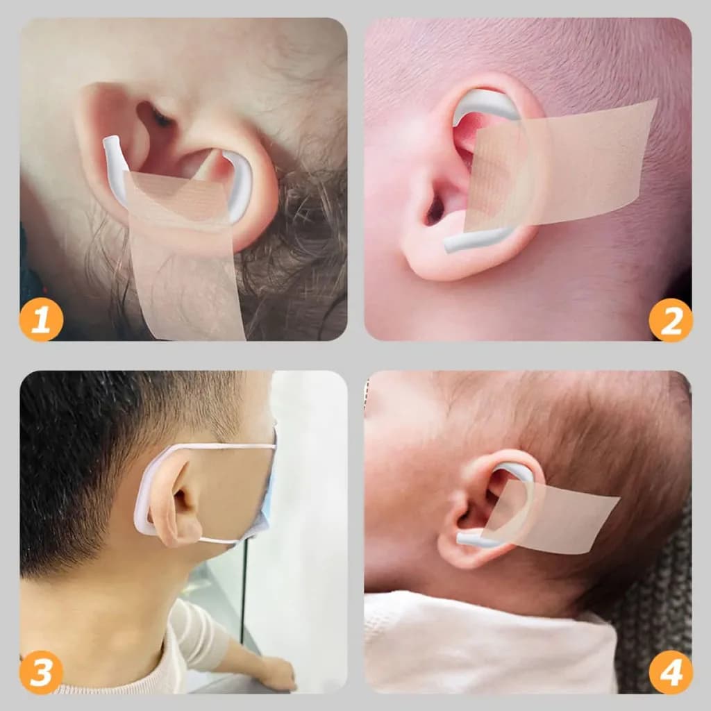 چسب اصلاح گوش نوزاد 4در100 سانت Aike — تصویر ۵