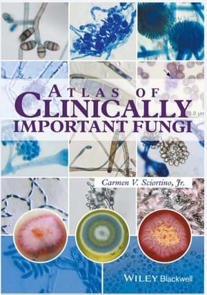 دانلود کتاب Atlas of Clinically Important Fungi