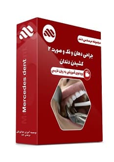 ویدئوی دهان و فک و صورت 2 کشیدن دندان