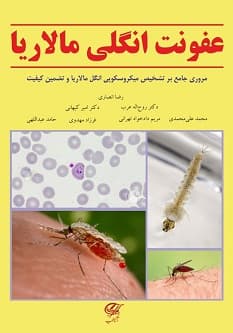 عفونت انگلی مالاریا