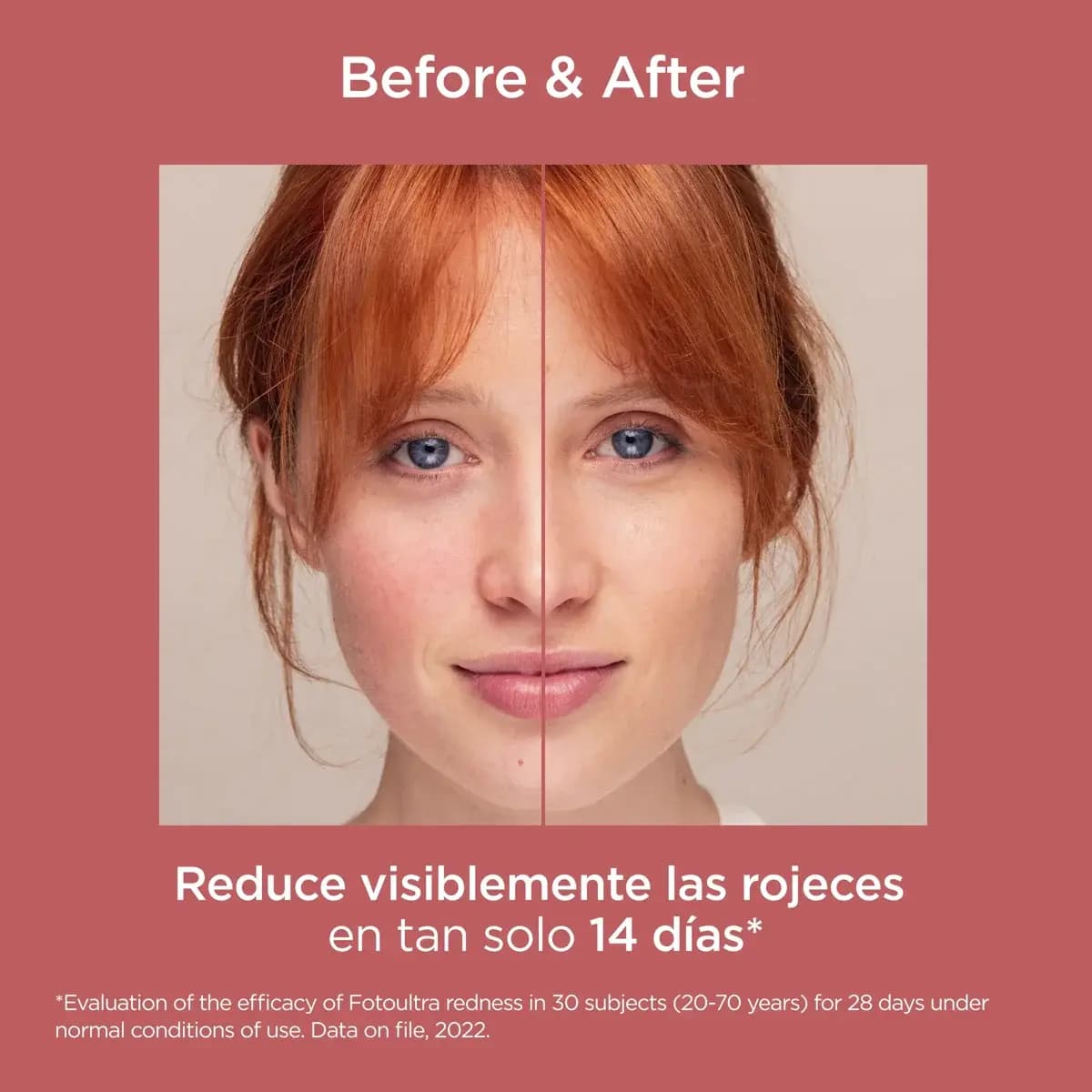 ضد آفتاب ضدقرمزی ایزدین SPF50 (پوست حساس، ملتهب و قرمز) — تصویر ۷