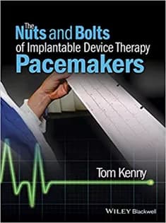 دانلود کتاب The Nuts and Bolts of Implantable Device Therapy Pacemakers
