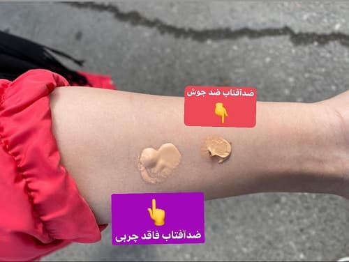 ضدآفتاب فاقد چربی آنتی آکنه رنگی(رنگ طبیعی) اریکه 50 میل — تصویر ۲