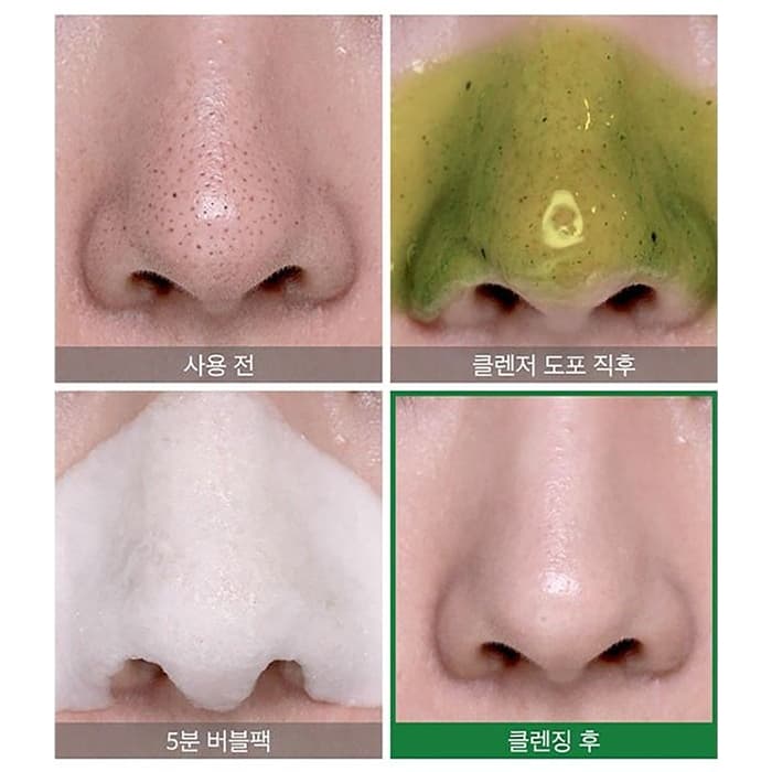 شوینده حبابی جوش سرسیاه somebymi — تصویر ۲