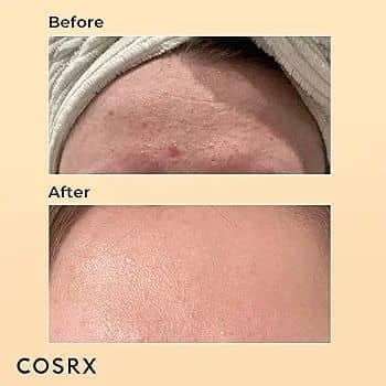 اسنس حلزون کوزارکسCOSRX مدل پمپی 96% حجم 100 گرم — تصویر ۲