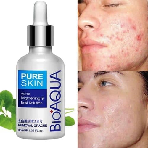 سرم ضد جوش بیوآکواBIOAQUA مدل پیور اسکین Pure Skin حجم 30 میلی لیتر — تصویر ۲