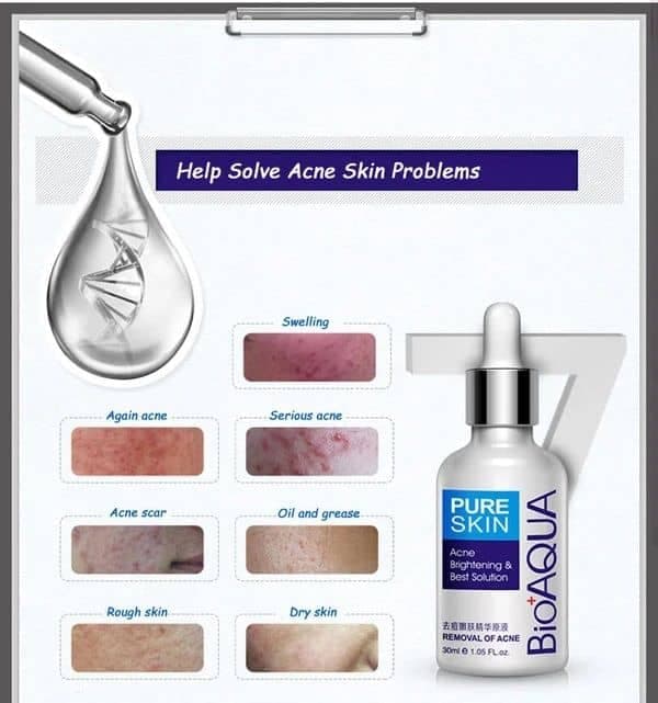 سرم ضد جوش بیوآکواBIOAQUA مدل پیور اسکین Pure Skin حجم 30 میلی لیتر — تصویر ۳