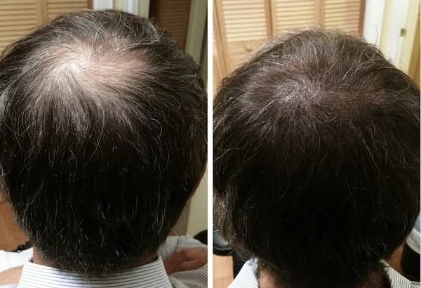 کربوکسی مو ژنوسیس کره حجم 250 میلی لیتر — تصویر ۶