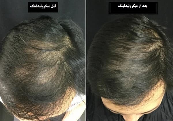 کربوکسی مو ژنوسیس کره حجم 250 میلی لیتر — تصویر ۵