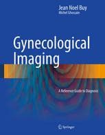 Gynecological Imaging: A Reference Guide to Diagnosis