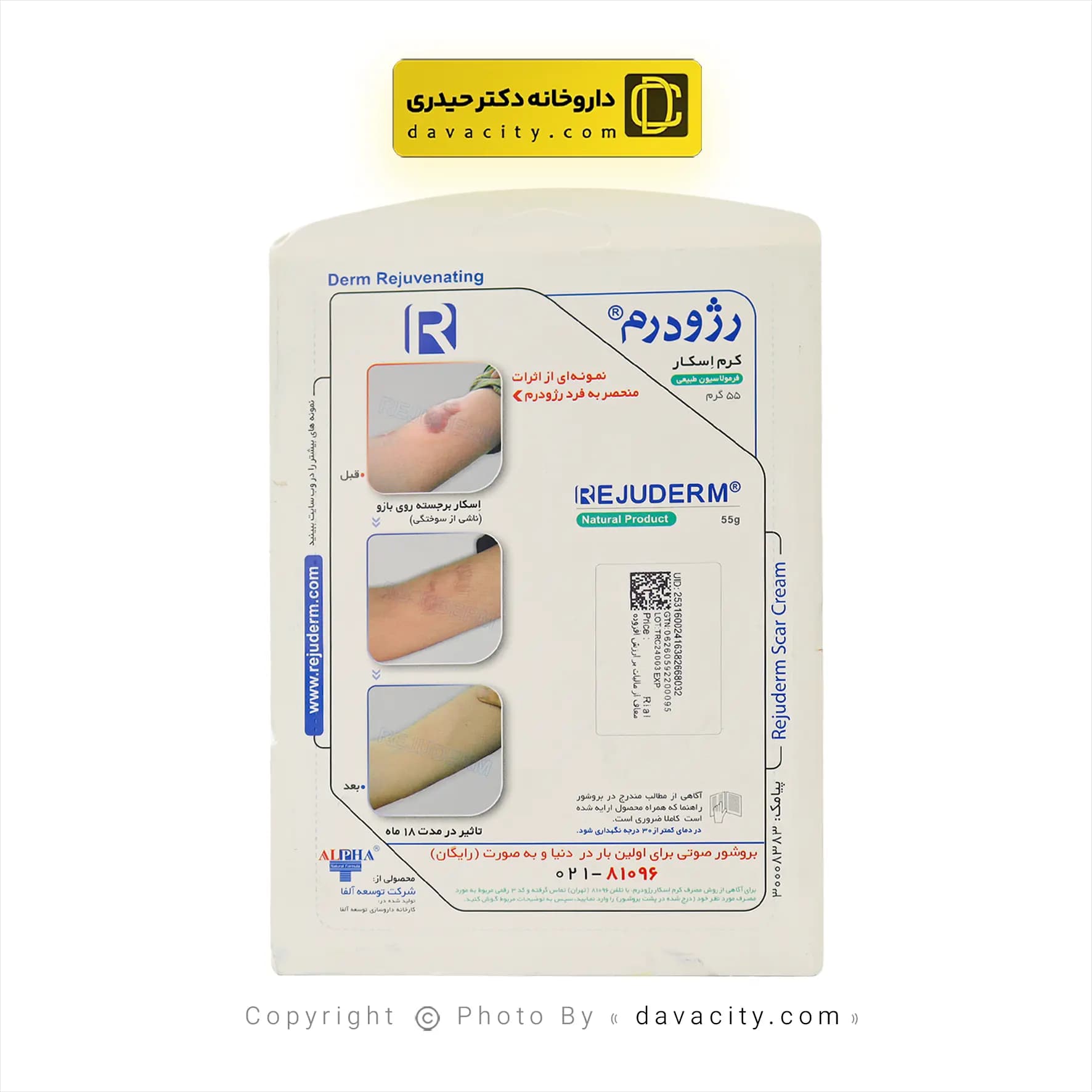 کرم ترمیم کننده اسکار رژودرم 55 گرم — تصویر ۳