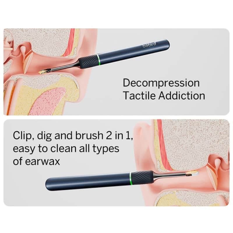 گوش پاک کن شیائومی مدل Bebird Note 5 (اورجینال پلمپ ارسال فوری) — تصویر ۲