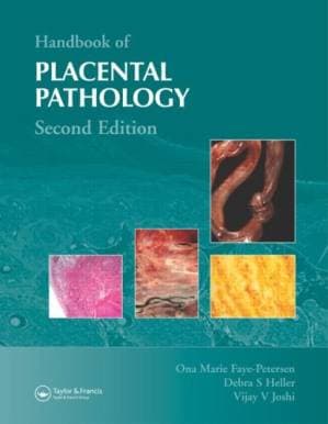 دانلود کتاب Handbook of Placental Pathology, Second Edition