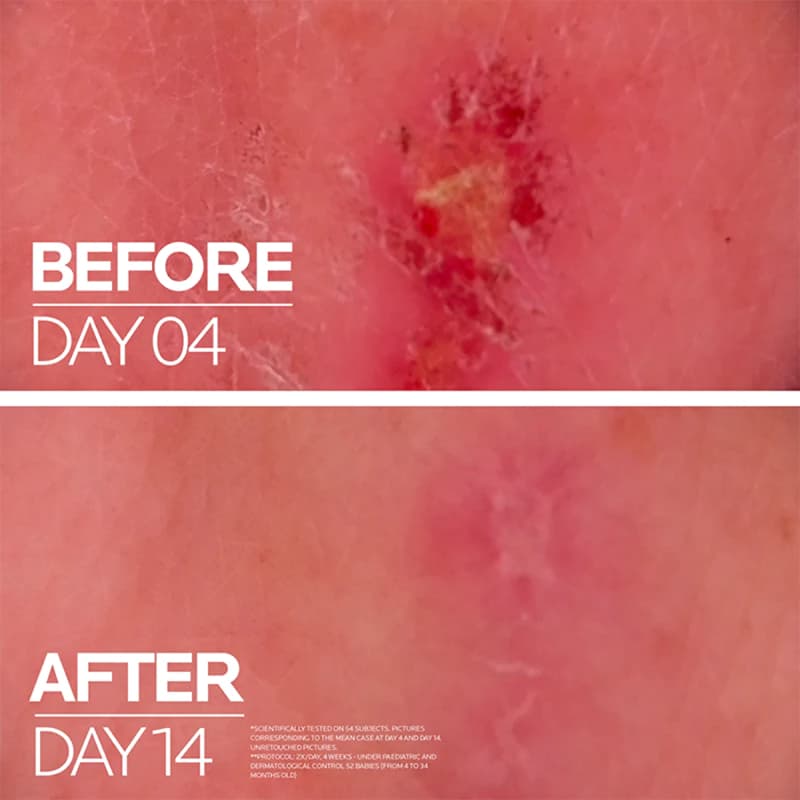 کرم ترمیم کننده لاروش پوزای مدل +CICAPLAST BAUME B5 حجم 40 میل — تصویر ۵