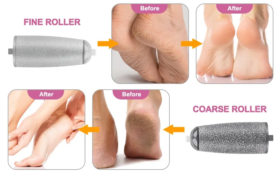 سوهان و سنگ پا شارژی Pedi Set of Two | ضد پینههای سخت کف پا | دو سری قابل تعویض | ایدهآل| 4 قسطی✅ — تصویر ۲