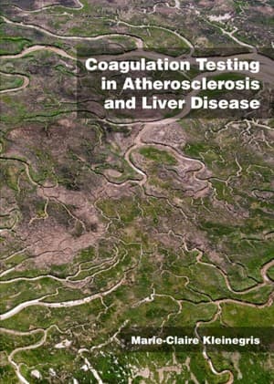 دانلود کتاب Coagulation testing in atherosclerosis and liver disease
