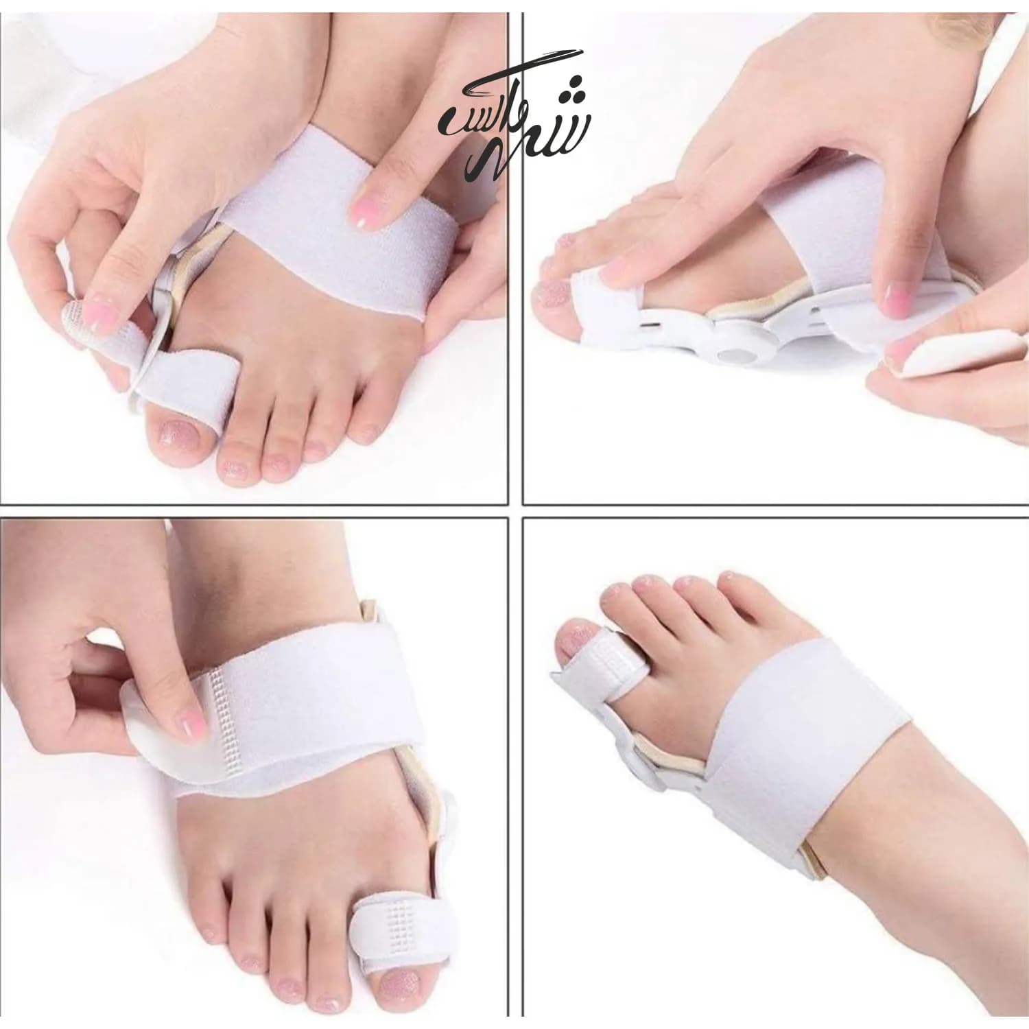 اصلاح کننده انگشت شست پا اسپلینت ژله ای — تصویر ۳