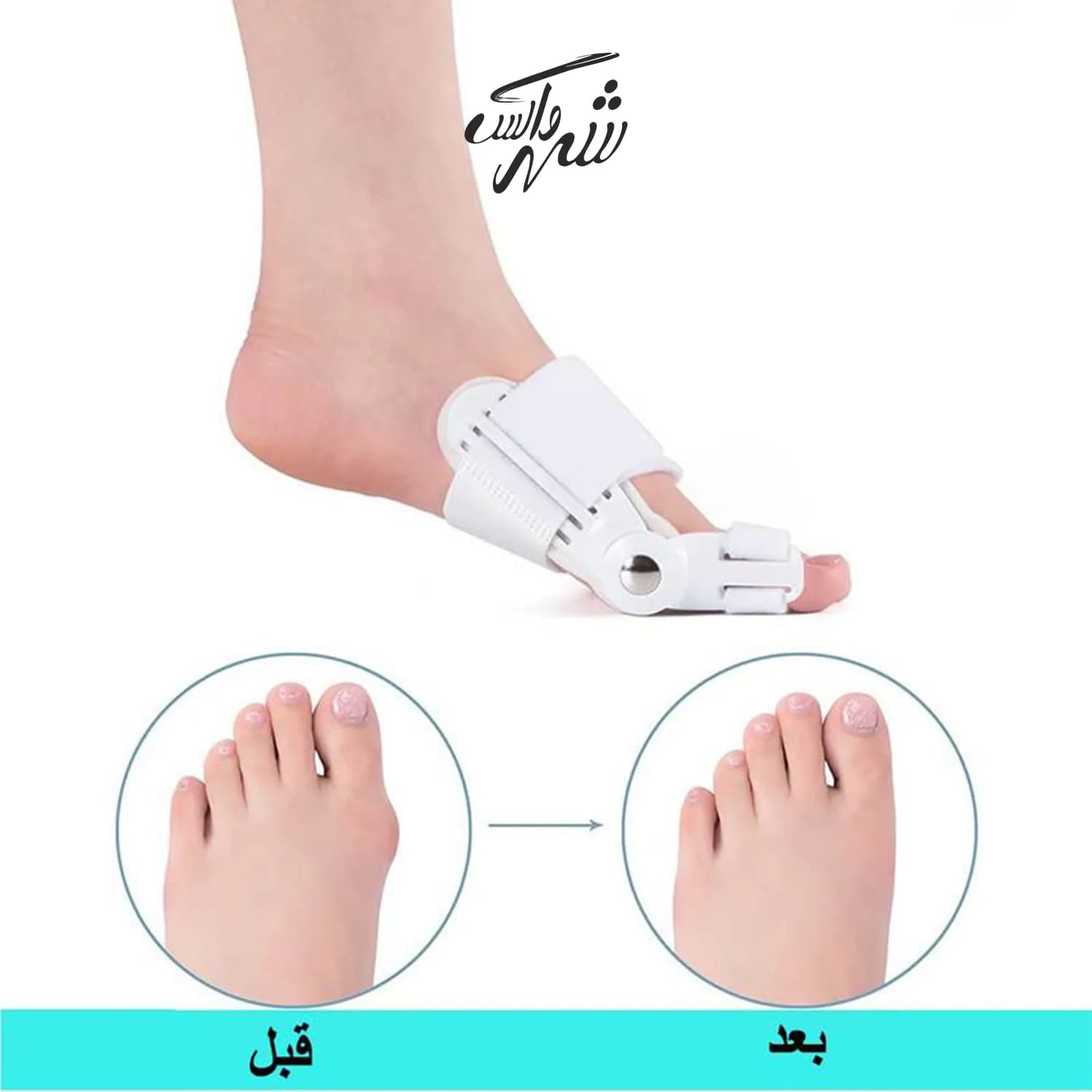 اصلاح کننده انگشت شست پا اسپلینت ژله ای — تصویر ۲