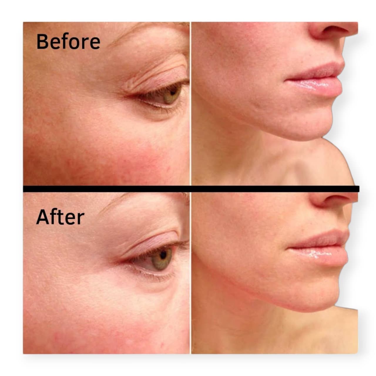 سرم بافِت (بافه) BUFFET و پپتید مس COPPER PEPTIDES یک درصد اوردینریOrdinary حجم 30 میل — تصویر ۲