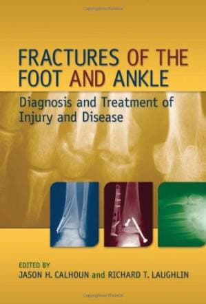 دانلود کتاب Fractures of the Foot and Ankle: Diagnosis and Treatment of Injury and Disease