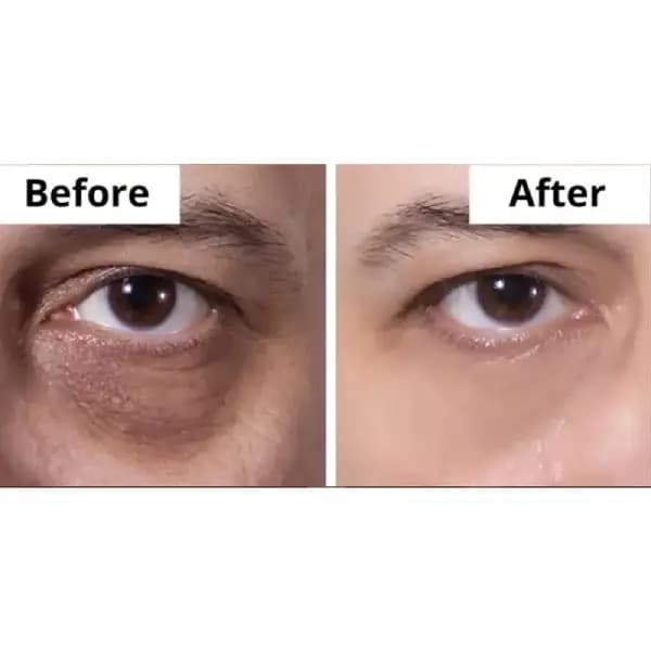 کرم دور چشم لیفت کننده Vital Perfection شیسیدو — تصویر ۱۰