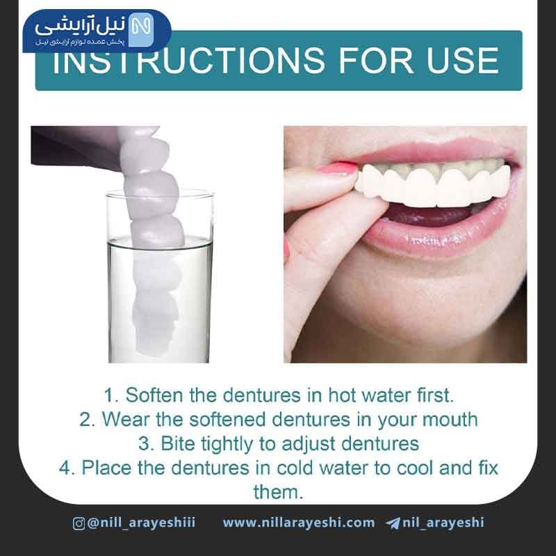 لمینت متحرک دندان ایلهو — تصویر ۳