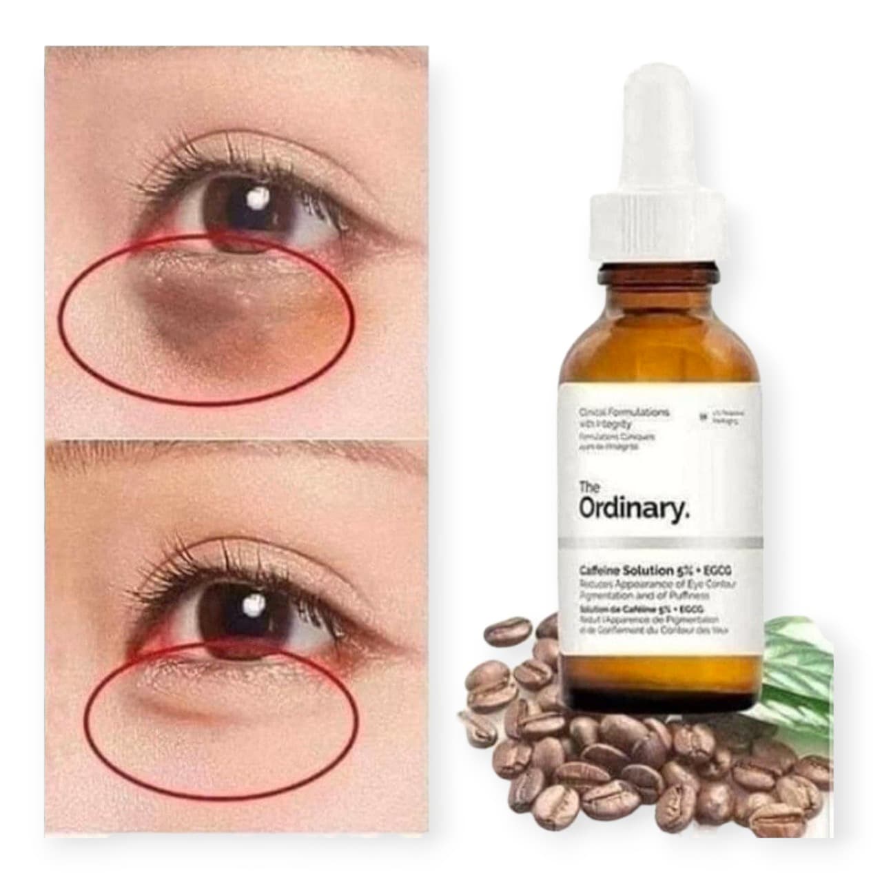 سرم کافئین 5% اوردینریOrdinary ضد تیرگی و پف دور چشم حجم 30 میل — تصویر ۲