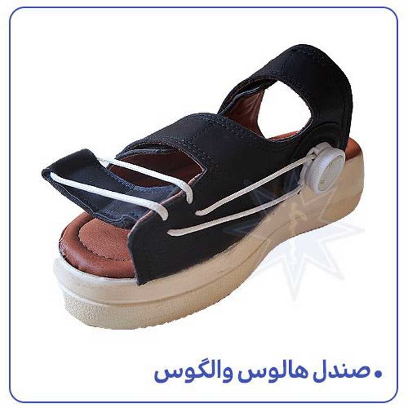 صندل طبی هالوس والگوس (قوز شست پا) | اصلاح‌کننده وضعیت و کاهش درد