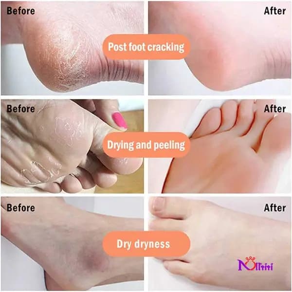 اسپری رفع ترک و پینه پا راکو (RAKO) مدل لایه‌بردار فوری (کف‌سابی خانگی) حجم 150 میل — تصویر ۴