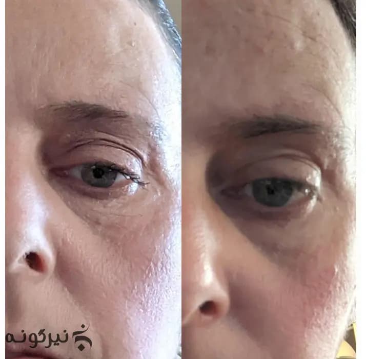 سرم بافه اوردینری مولتی پپتاید و جوانساز — تصویر ۳