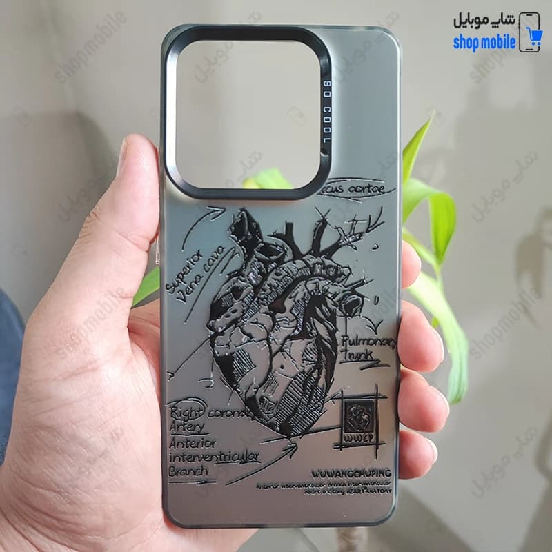 قاب گوشی شیائومی ردمی نوت 13 4G (کاور فانتزی So Cool طرح آناتومی قلب)