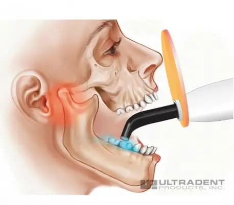 لایت شیلد دستگاه لایت کیور اولترادنت -Ultradent Valo Cordless Light Shield — تصویر ۲