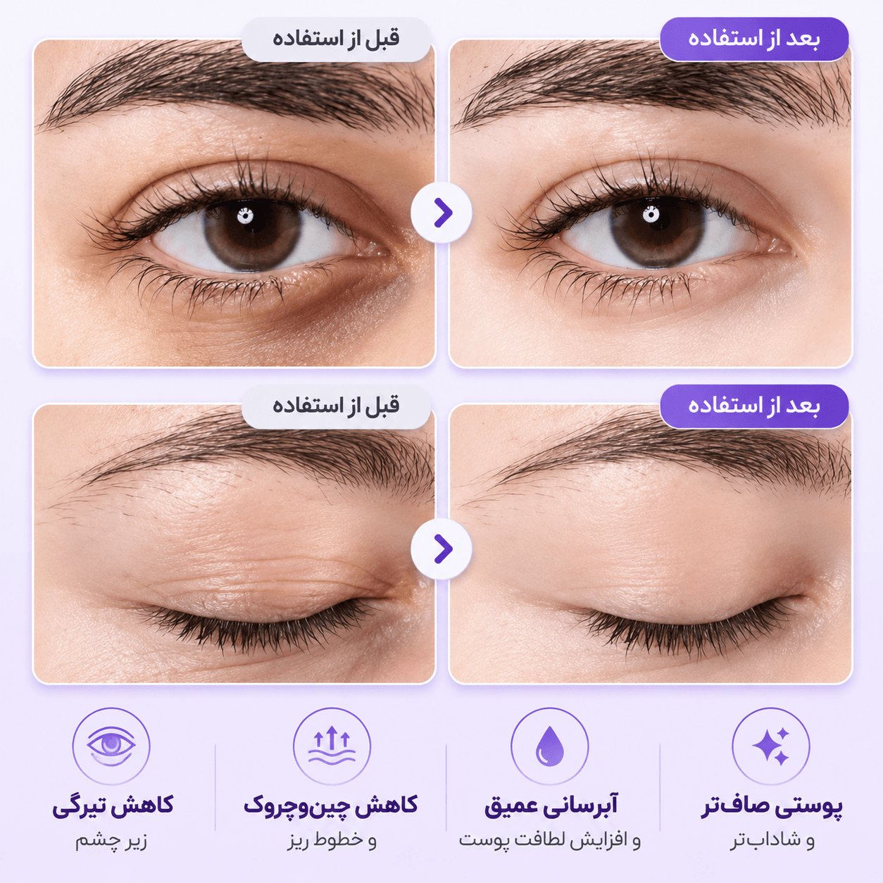نامبوزین کرم دور چشم NAD+رتینول تیوپی حجم ۲۰ میل — تصویر ۲