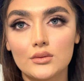 لنز رنگی سالانه آیس کالر لاکچری ماداگاسکار ICE COLOR LUXURY MADAGASKAR — تصویر ۲