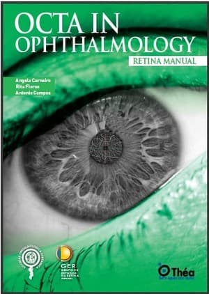 دانلود کتاب OCTA IN OPHTHALMOLOGY Retinal Manual