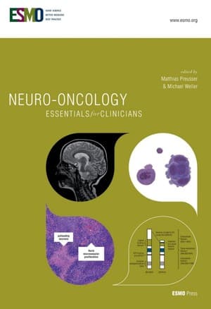 دانلود کتاب Neuro-Oncology Essential for Clinicians