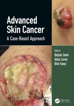دانلود کتاب Advanced Skin Cancer