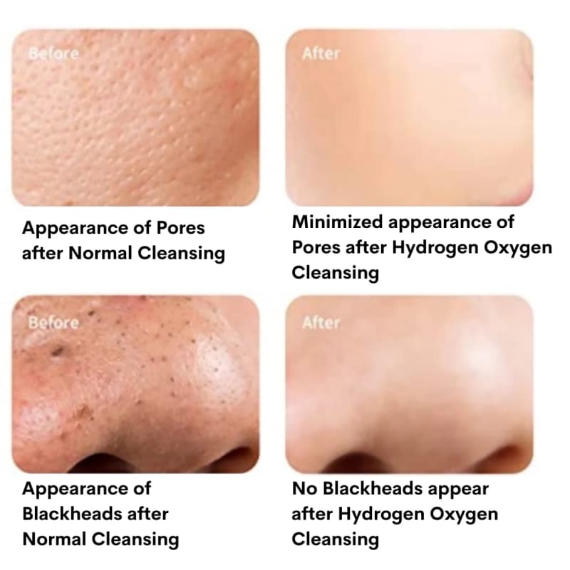 هیدروفیشیال 7 کاره برند هایکو — تصویر ۵